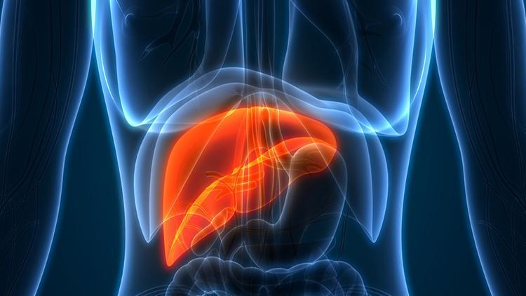 Karaciğer yağlanması neden olur, belirtileri nelerdir? Karaciğer yağlanmasına iyi gelen bitkisel besinler