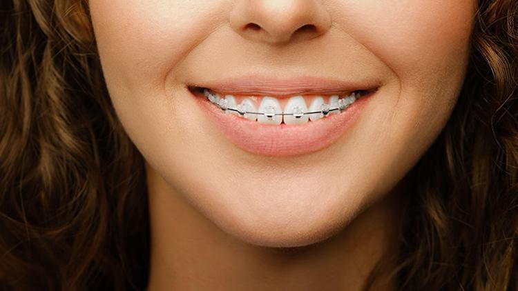 Diş Telinin Alternatifi Var mı?