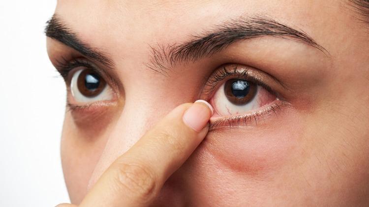 Ekran Başı Hastalığı: Göz Kuruluğu Belirtileri ve Tedavisi