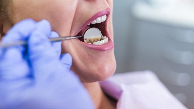 Ağız ve Diş Sağlığı Psikolojiyi Nasıl Etkiliyor? 
