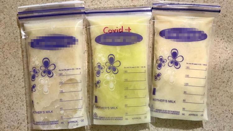 Meksika’da akılalmaz olay: Koronavirüse yakalanan annenin sütü açık yeşil oldu