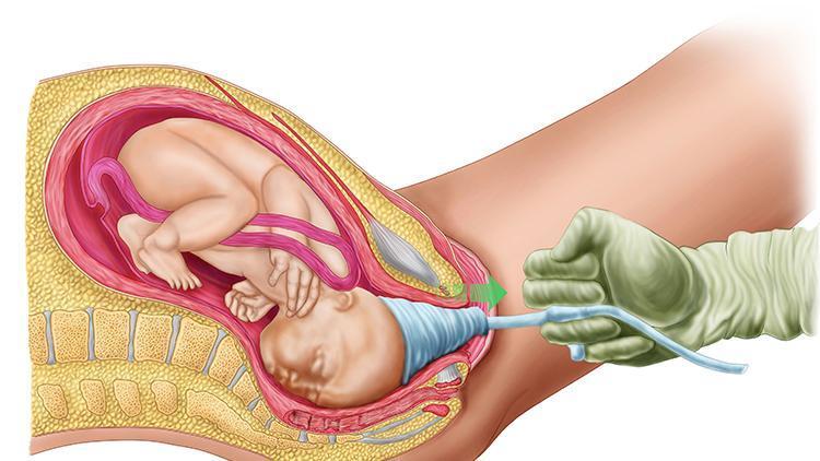 Bebek plasentası nedir, nasıl oluşur