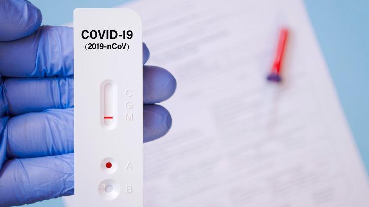 Covid-19 testim haftalardır pozitif çıkıyor… Virüsü bulaştırır mıyım