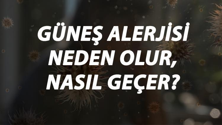 Güneş Alerjisi Nedir, Neden Olur Ve Nasıl Geçer Güneş Alerjisi Belirtileri Ve Tedavisi Hakkında Bilgi