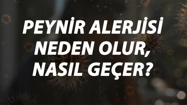 Peynir Alerjisi Nedir, Neden Olur Ve Nasıl Geçer Peynir Alerjisi Belirtileri Ve Tedavisi Hakkında Bilgi