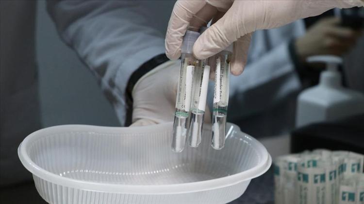 İsveçte sahte PCR testi skandalı İnceleme başlatıldı
