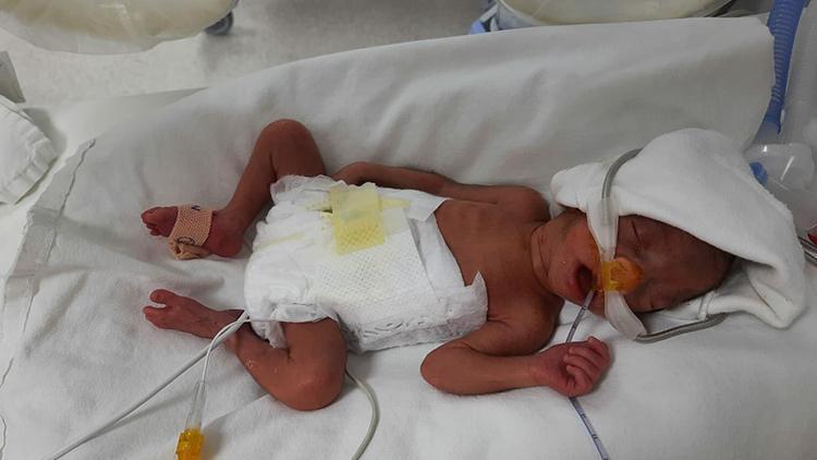 Manisada 850 gram doğan Müge bebek, yaşam savaşını kazandı