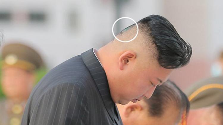 Dünya bu fotoğrafları konuşuyor... Kim Jong Unun son hali görenleri şoke etti