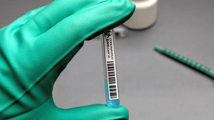 Testlerin ücretli olması etkili oldu: Aşıya gidenlerin sayısı arttı
