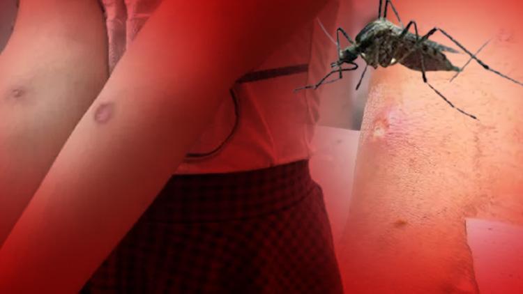 Sivrisinek tehlikesi 3 ölümcül hastalık riski var: Bu belirtilere dikkat