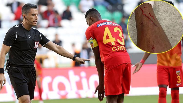 Kayserisporda kaptan Bernard Mensahtan maç sonu hakem paylaşımı