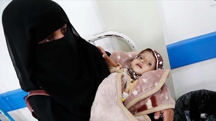 DSÖ: Yemende çocukların yüzde 75i yetersiz besleniyor