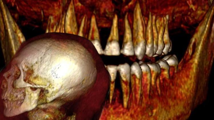 Üç bin 500 yıllık mumya tüm sırları açığa çıkardı