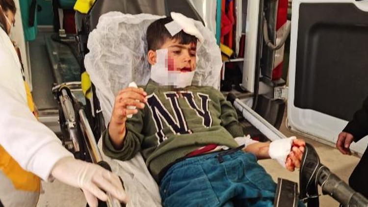 Köpeklerin saldırısına uğradı... 7 yaşındaki Ahmet ağır yaralı