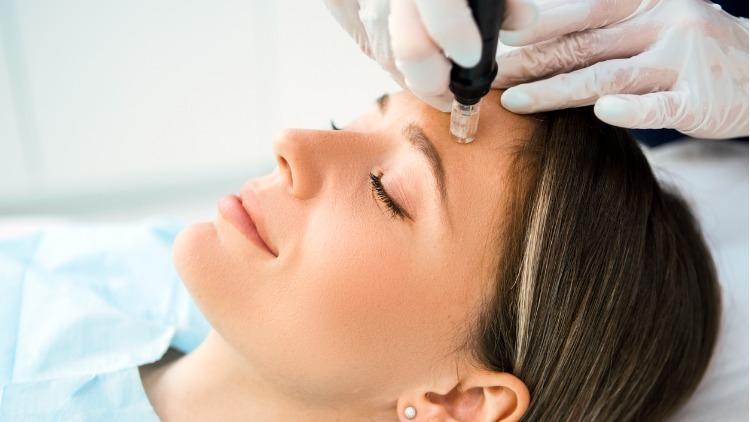 Dermapen Nedir, Ne İşe Yarar? Cilt Tedavisinde Dermapen Faydaları ve Zararları