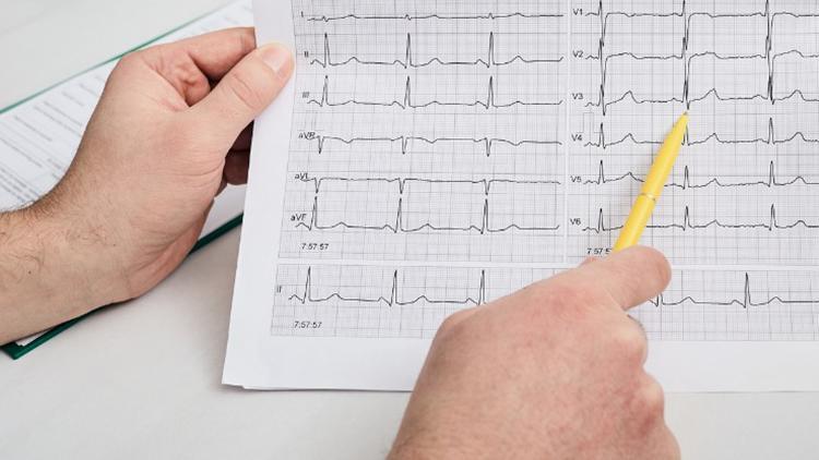 EKG nedir, nasıl çekilir? EKG neden çekilir?