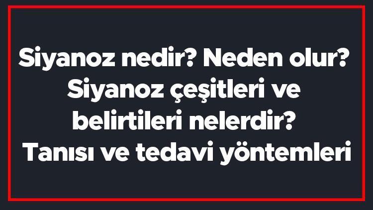 Siyanoz nedir Neden olur Siyanoz çeşitleri ve belirtileri nelerdir Tanısı ve tedavi yöntemleri