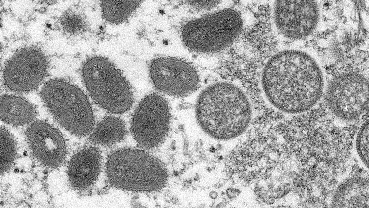 Maymun çiçeği salgınında kritik gelişme: Nijeryada maymun çiçeği virüsüne bağlı ilk ölüm gerçekleşti