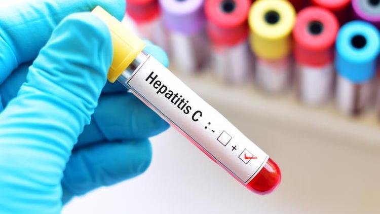 Hepatit C nedir ve belirtileri nelerdir