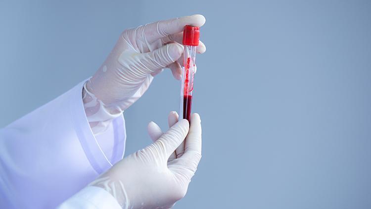 ABDli bilim insanlarından dikkat çeken araştırma: En riskli kan grubunu açıkladılar