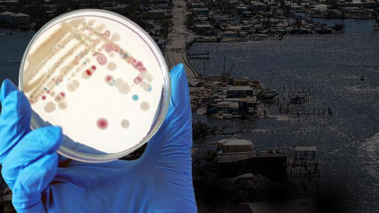 ABDde et yiyen bakteri paniği Vaka sayısı 65e yükseldi...