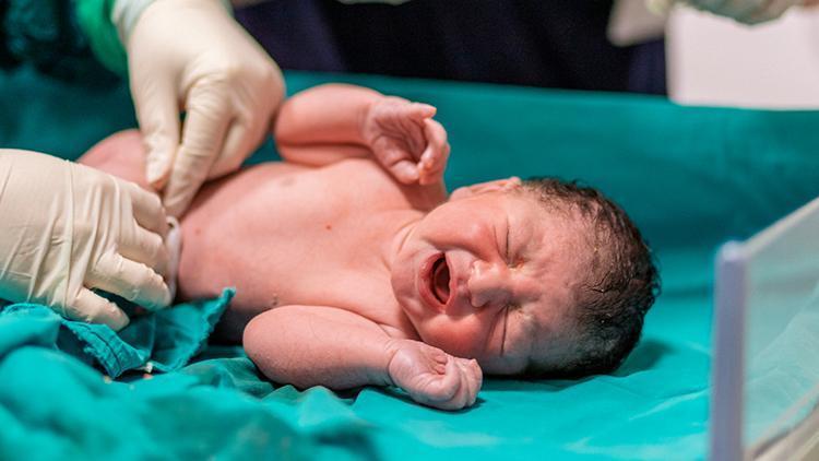 21 günlük bebeğin karnından 8 tane embriyo çıktı Doktorlar gözlerine inanamadı...