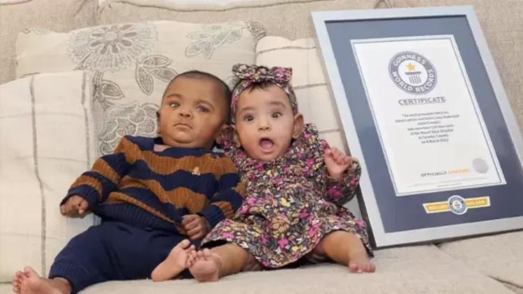 Dünyanın en erken doğan ikizleri...Guinness Rekorlar Kitabına girdiler