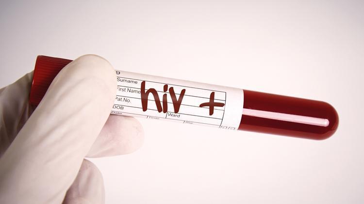 770 bin TL’lik HIV’li kan cezası