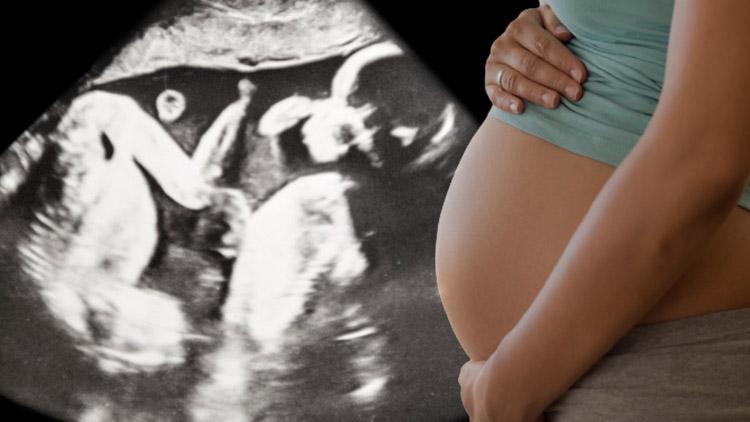 28 gün içinde iki kez hamile kaldı ve bebeklerini aynı anda doğurdu... ‘Anlattığımda insanlar çıldırmış olduğumu düşünüyor’