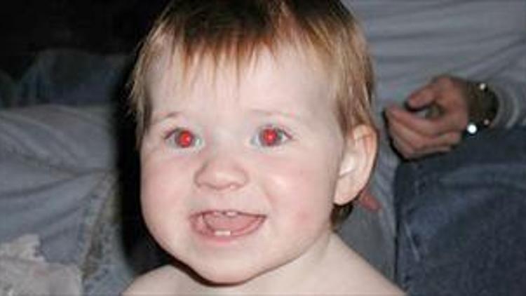 Gözlerin kırmızı çıkması sağlığa işaret