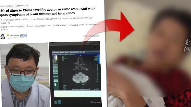 Yemek yediği restorandaki bir yabancı görünüşüne bakıp teşhis koydu: Beyninizde tümör olabilir