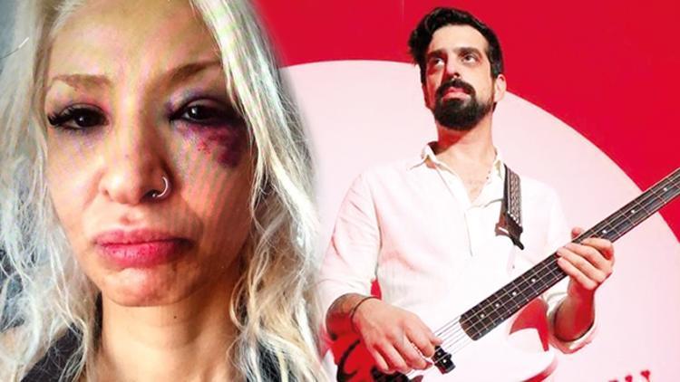 Şoke eden iddia... Müzisyen Can Tunaboylu sevgilisi Aybike Çelike şiddet uyguladı
