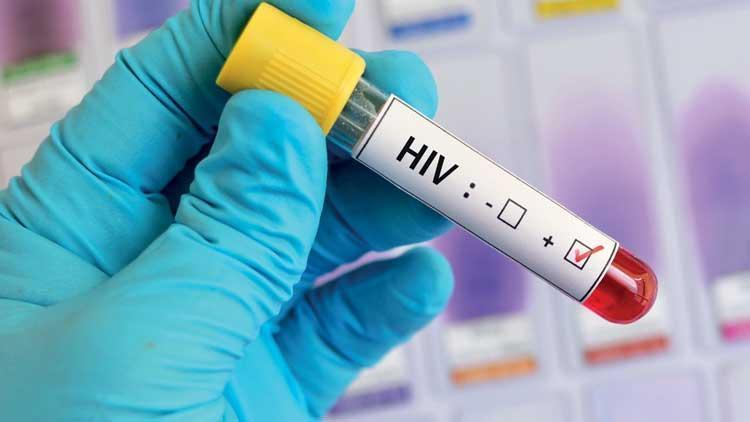 Türkiye’de HIV 4 kat arttı... ‘Sinsi pandemi’ yine sahnede