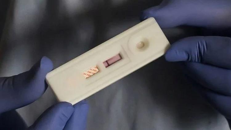 Karabükte HIV ve HPV pozitif vakalarında artış iddiasına yalanlama