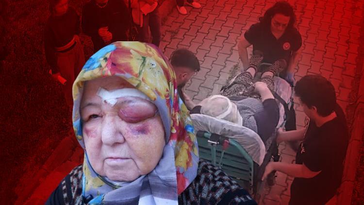 Edirnede sokak köpeklerinin saldırdığı yaşlı kadın kamerada