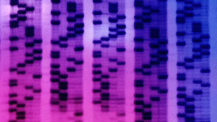 Prostat kanserini erken teşhis edebilen tükürük testi