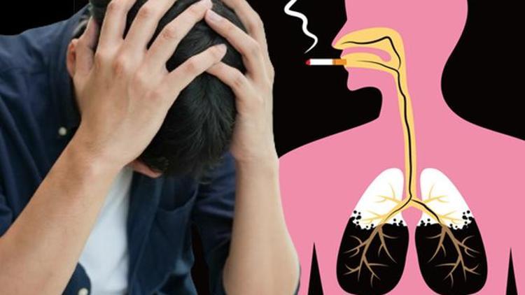 Doktorları bile şaşırttı: Sigara boğazında kıllanma yaptı 14 yıl boyunca devam etti...  ‘Kıllı dil sorunuyla başvuran hastalar da var’