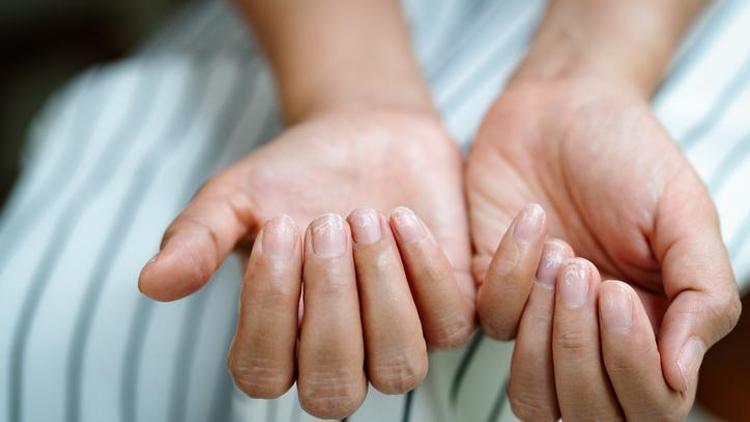 Bu haberi okurken ellerinize ve tırnaklarınıza çok dikkatli bakın Önemsiz zannediyoruz ama çok ciddi tehlikelerin habercisi