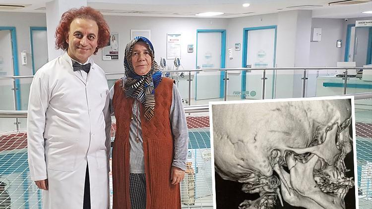 Ağrılardan çığlık atasım geliyordu | 15 yıllık şiddetli boyun ağrısının nedeni doktoru da şaşırttı: Nadir görülen bir sendrom