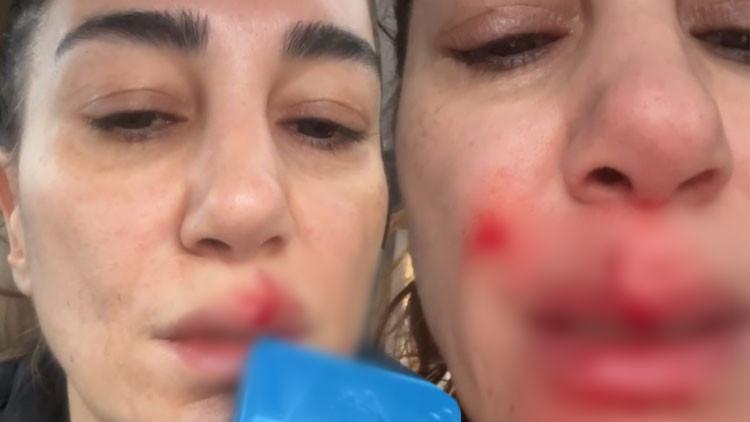 Evde talihsiz kaza... Bir anda kanlar içinde kaldı