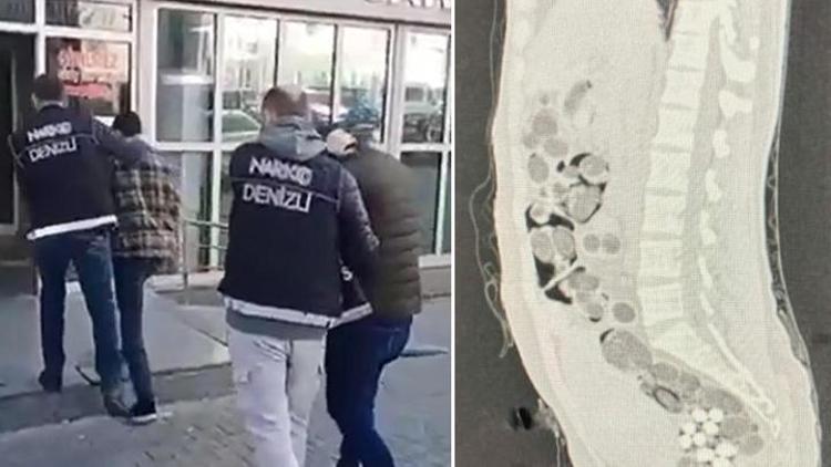 Denizlide uçaktan inen yabancı kuryenin midesinden 219 paket uyuşturucu çıktı 2 kişi tutuklandı