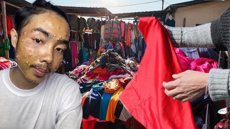 Satın aldığı kıyafeti giydi ve hayatı altüst oldu Sakın bunu yapmayın O kıyafetler mikrop içinde yüzüyor”