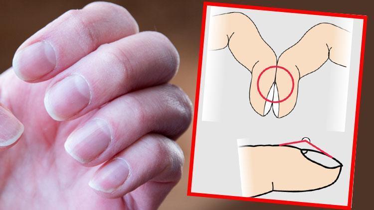 Ölümcül hastalığın sessiz işareti: Parmaklarda görülen bu değişikliğe dikkat! Basit bir testle anlamak mümkün…