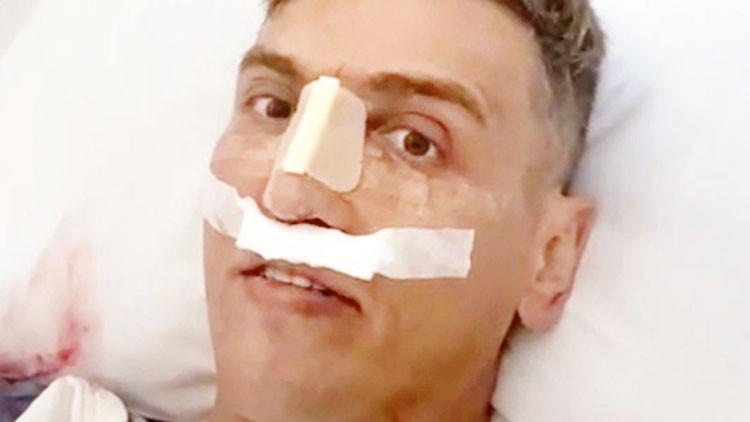 Burun ameliyatı sonu oldu
