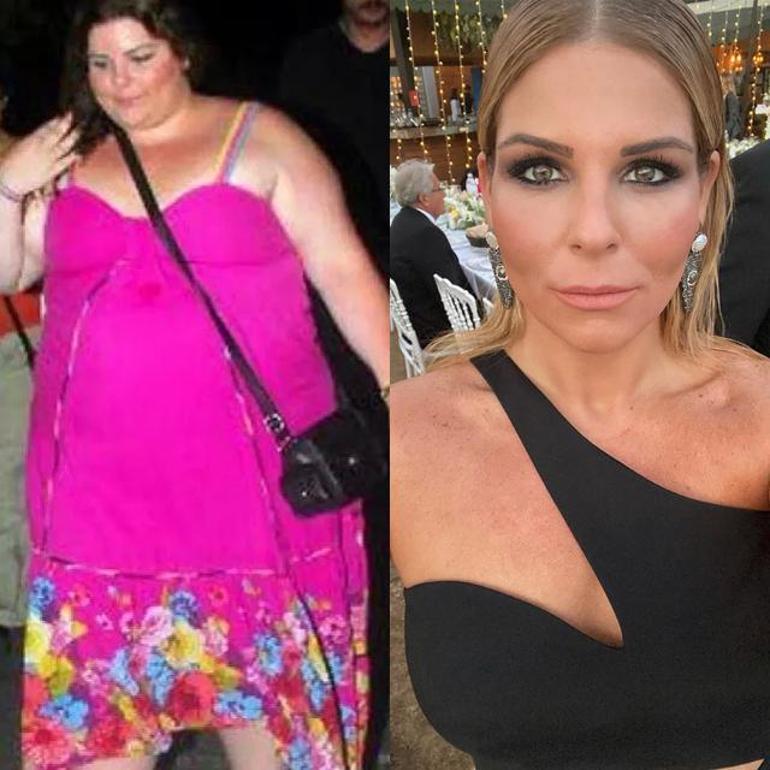 She lost 22 kg in 5 months... Ata Demirer's latest appearance was surprising