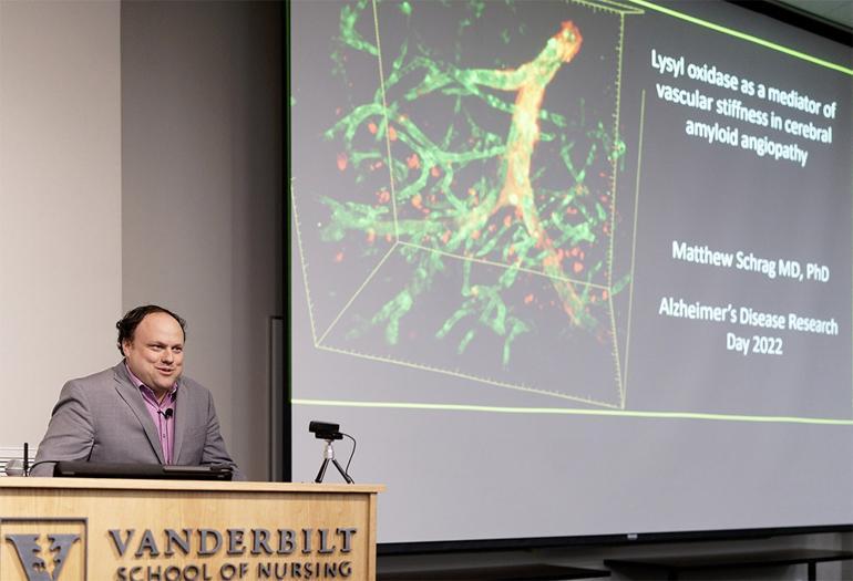 Alzheimer araştırmalarında şok 16 yıllık makale tartışma yarattı... Yüzlerce çalışma çöpe mi gidecek