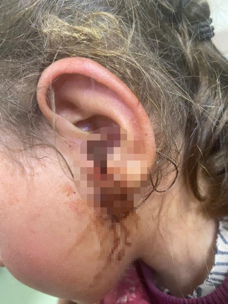 3 yaşındaki çocuğun kulağından çıktı: 23 adet, canlı haldeydiler