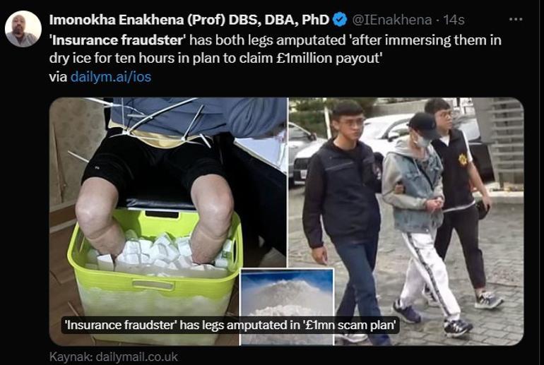 10 saat buzla dolu kovada bekletti, her iki baca�� da kesildi! Ak�lalmaz tazminat oyunu...