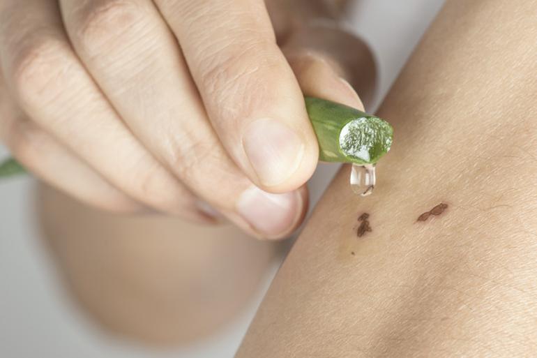 Topraktan çıkarıp elimize yüzümüze sürüyoruz Aloe vera gerçekten cilt için faydalı mı yoksa abartılıyor mu