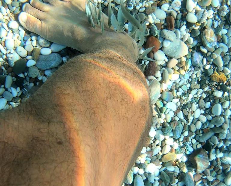 Akdenizin doktor balıkları... Prof. Dr. Gökoğlu: Yaranın daha çabuk iyileşmesini sağlıyor